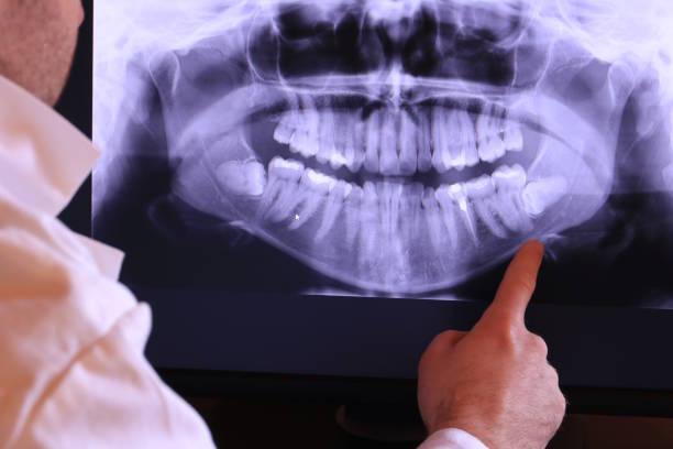 Best Emergency Gum Pain Relief  in Washington, IL